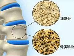超声骨密度检测仪，让您轻松了解您的