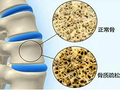 超声骨密度检测仪，让您轻松了解您的