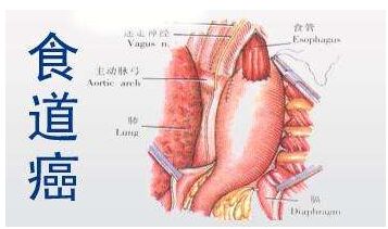 微量元素分析仪厂家谈食管癌和微量元素的关系