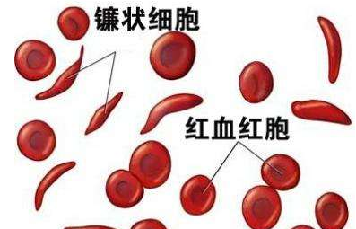 医用微量元素分析仪厂家谈孩子患缺铁性贫血怎么办